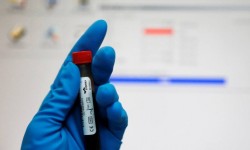 65498616_FILE-PHOTO-A-technician-holds-a-test-tube-with-a-blood-sample-at-th