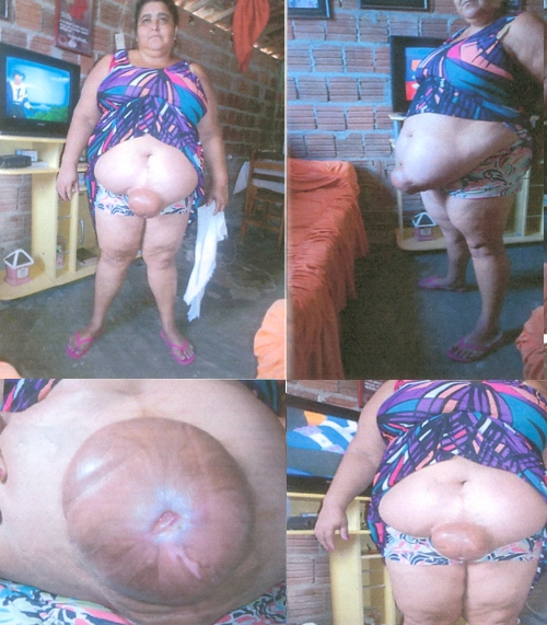 Mulher pode morrer por negligÃªncia de prefeito de Porto do Mangue