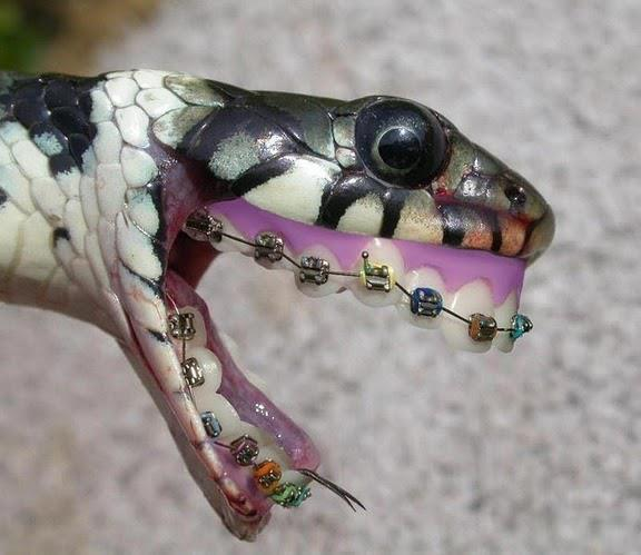 Sua sogra já botou aparelho nos dentes? Sacanagem... rsrsrs...
