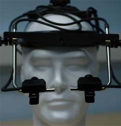 olhos-alzheimer Exame ocular simples pode indicar doença de Alzheimer