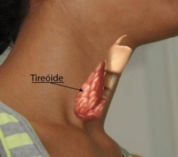 tireoide Publicação revela novo tipo de doença no Brasil