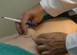 cirurgia plastica