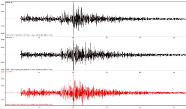 tremor