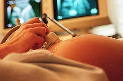 pre natal